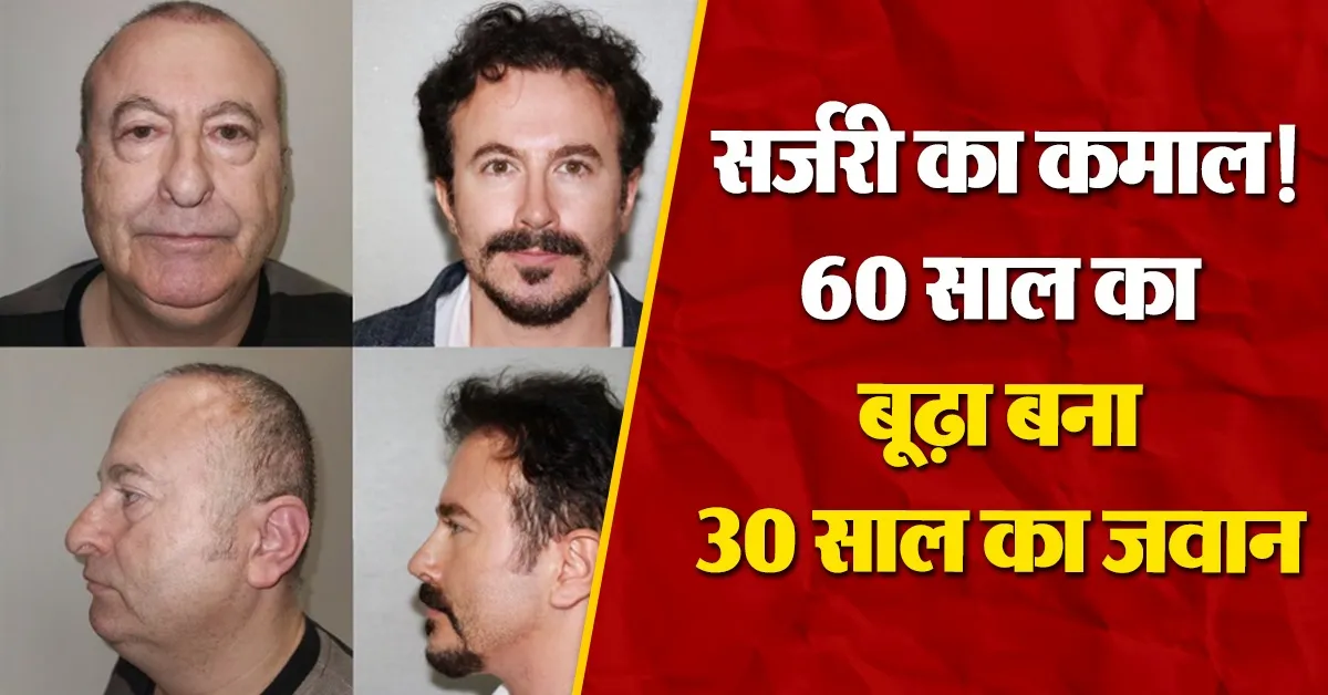 30 Years Younger Surgery