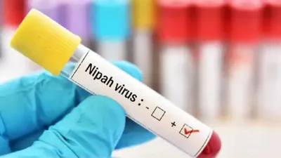 Nipah Virus