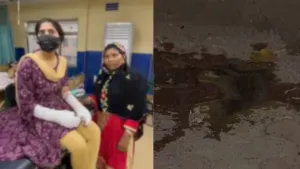 DU Acid Attack Case: DU की छात्रा पर 3 हैवानों ने किया एसिड अटैक, चेहरा बचाया, हाथ झुलसे, पीड़िता ने सुनाई आपबीती