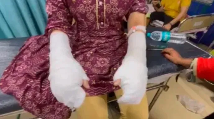 DU Student Acid Attack