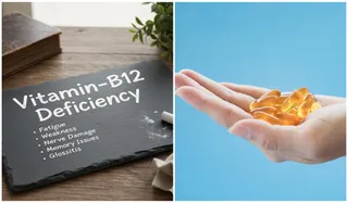 Vitamin-B12 Deficiency