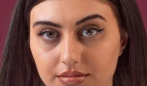 how to reduce dark circles