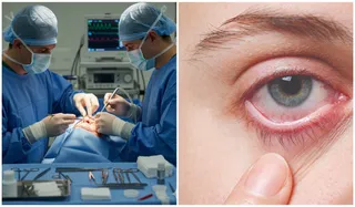 Eye Reconstruction Surgery