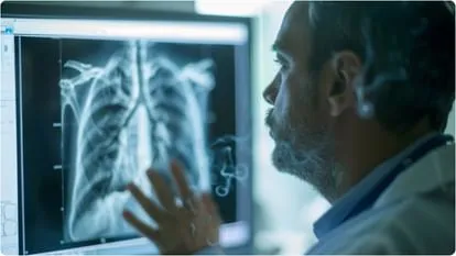 TB Cases in India