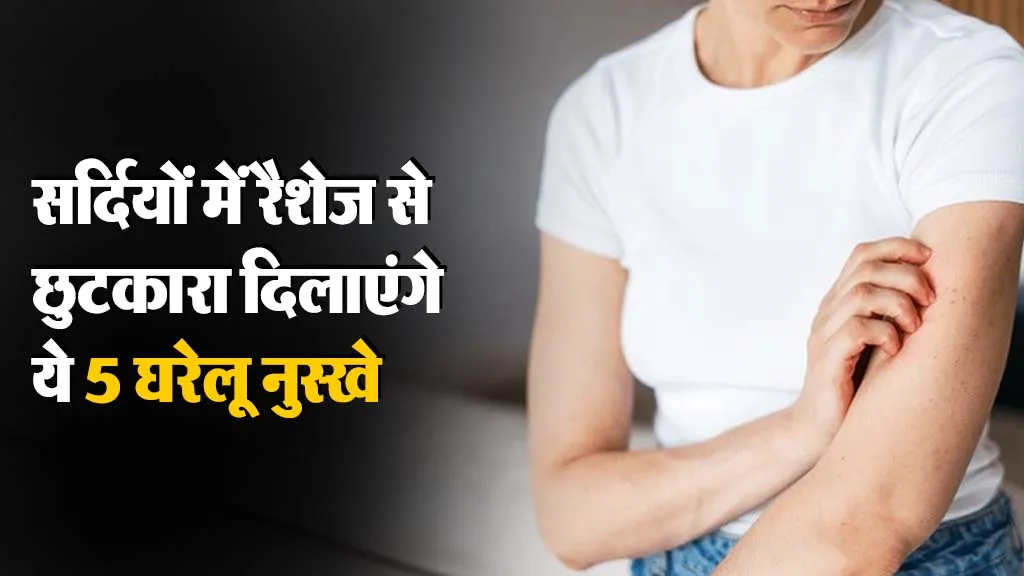 Winter Rash Home Remedy