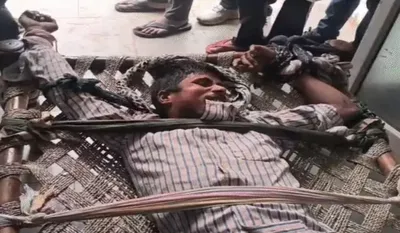 Aligarh Rabies Case