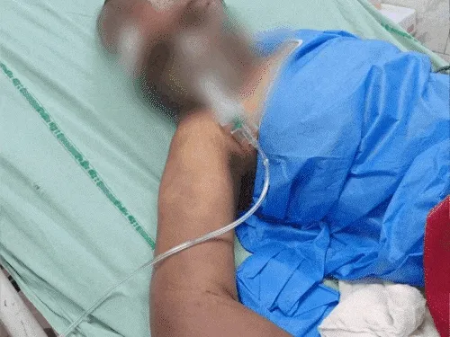 Girl private parts set on fire Gurugram