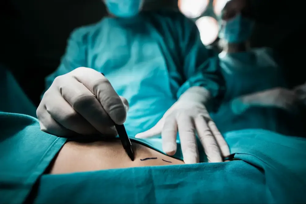 12th Class Student Performed C-Section
