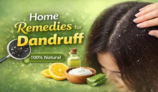 Home Remedies for Dandruff