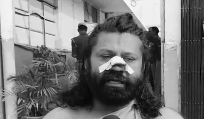 Ashutosh Brahmachari Attacked