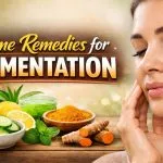 Home Remedies for Pigmentation