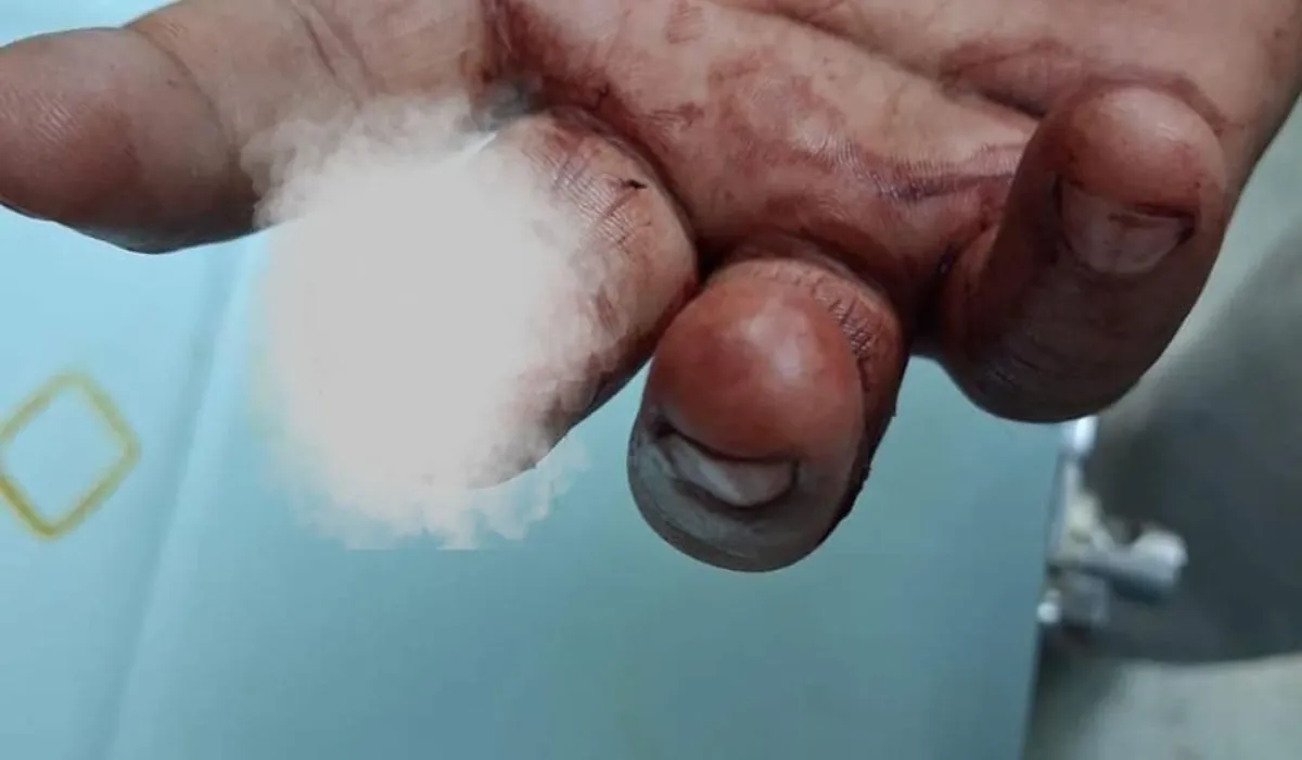 Mumbai customer bites shopkeeper fingers