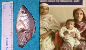 3-Inch Fish in Toddler Throat