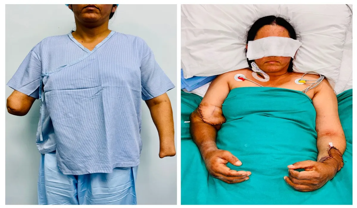 Sir Ganga Ram Hospital Surgery