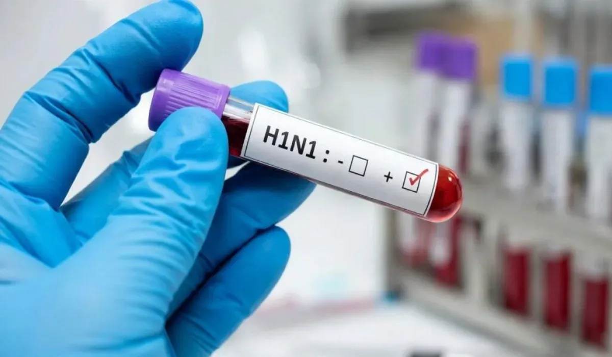 Swine Flu se Bachne ke Upay