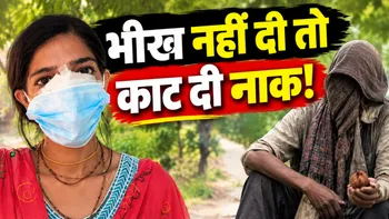 Beggar Bites Woman Nose