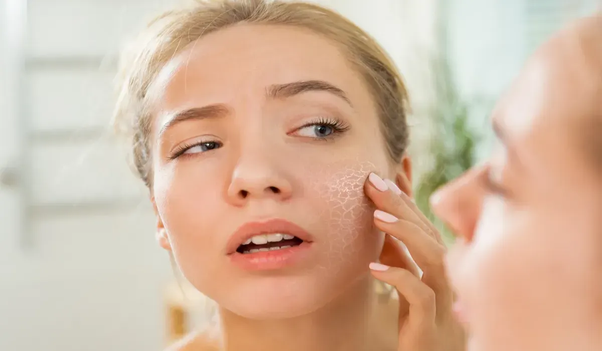 Natural Winter Skincare Tips