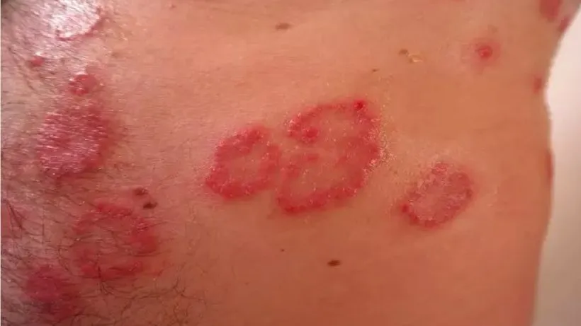 skin