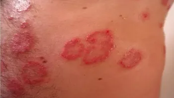 skin